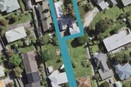 40 Grande Vue Road, Hillpark, Auckland