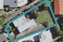 11 Knox Road, Hillpark, Auckland